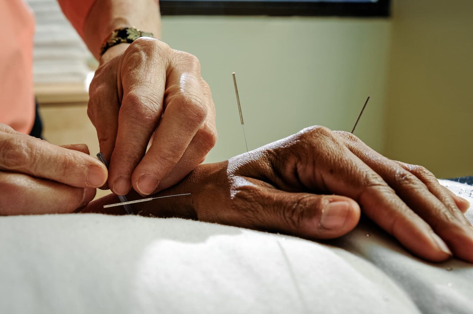 Dry Needling Therapy Near Me - HealthSource Chiropractic