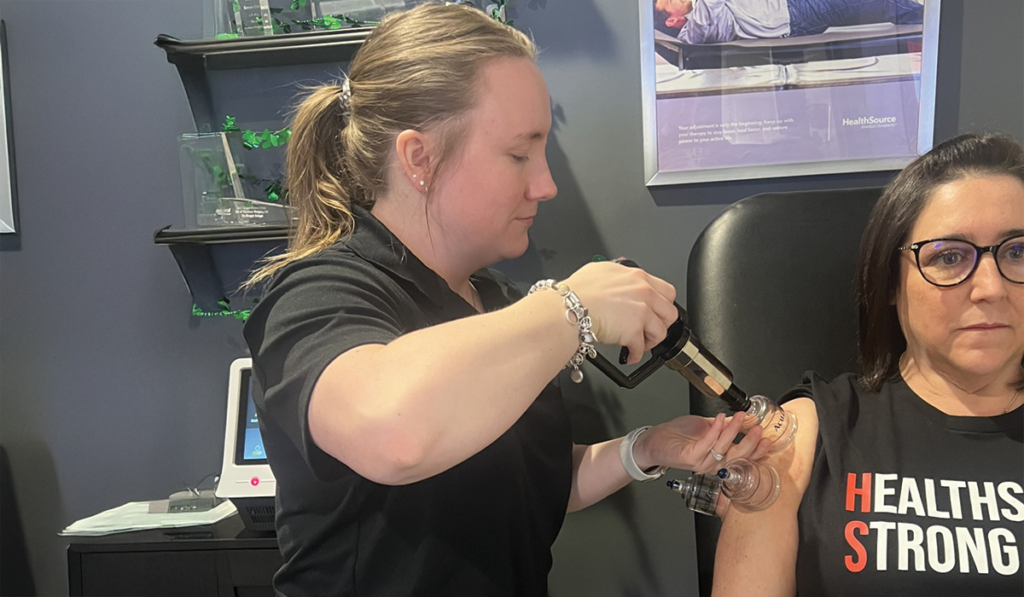 A patient at HealthSource of Troy receiving Cupping treatment.